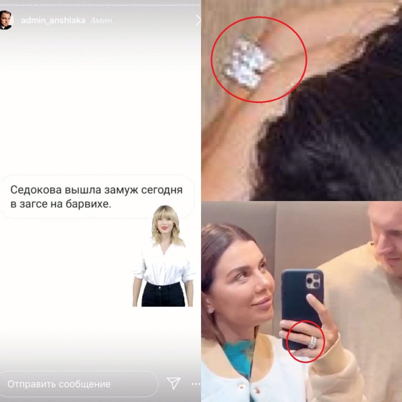Фотоколлаж: Анна Седокова показала обручальное кольцо, Instagram @annasedokova